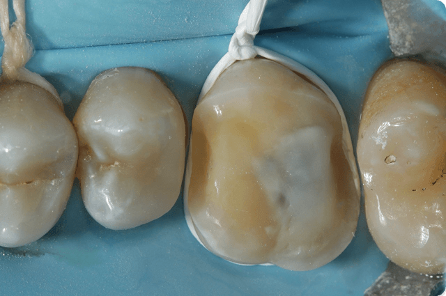 Clear Preparation Protocols