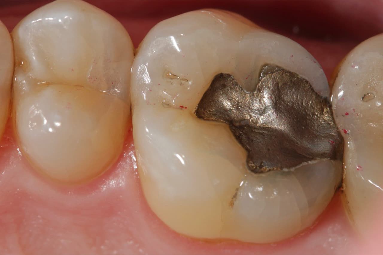 FIPO protocol step 1