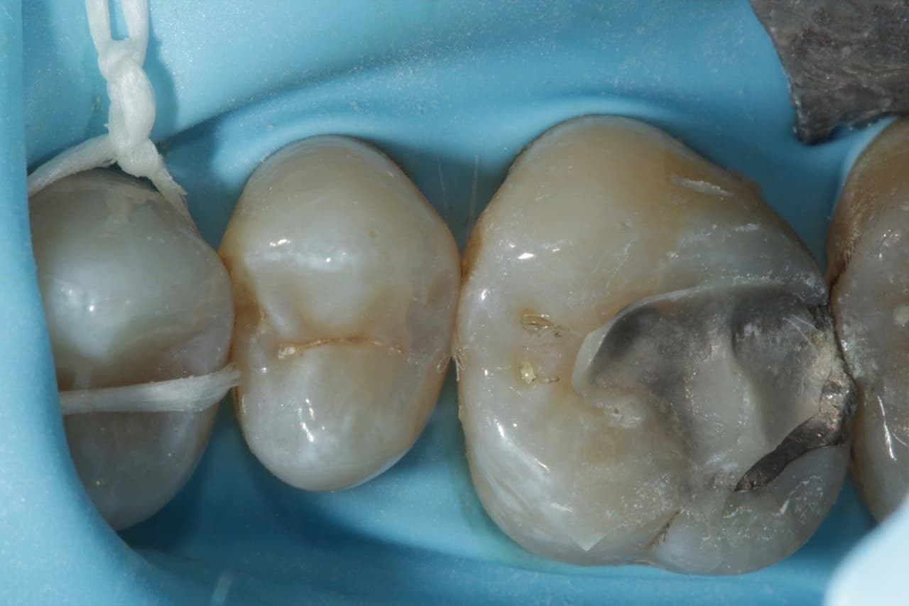 FIPO protocol step 2