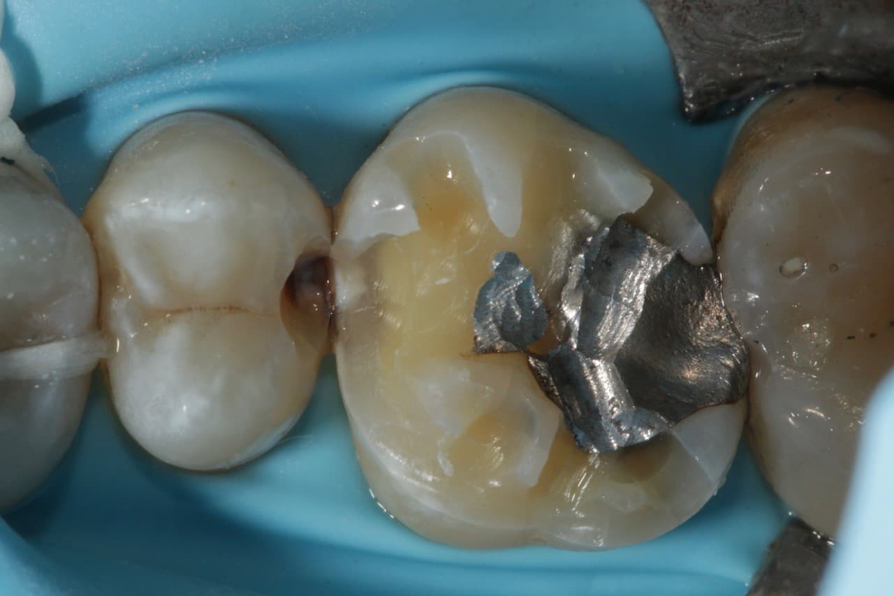 FIPO protocol step 3