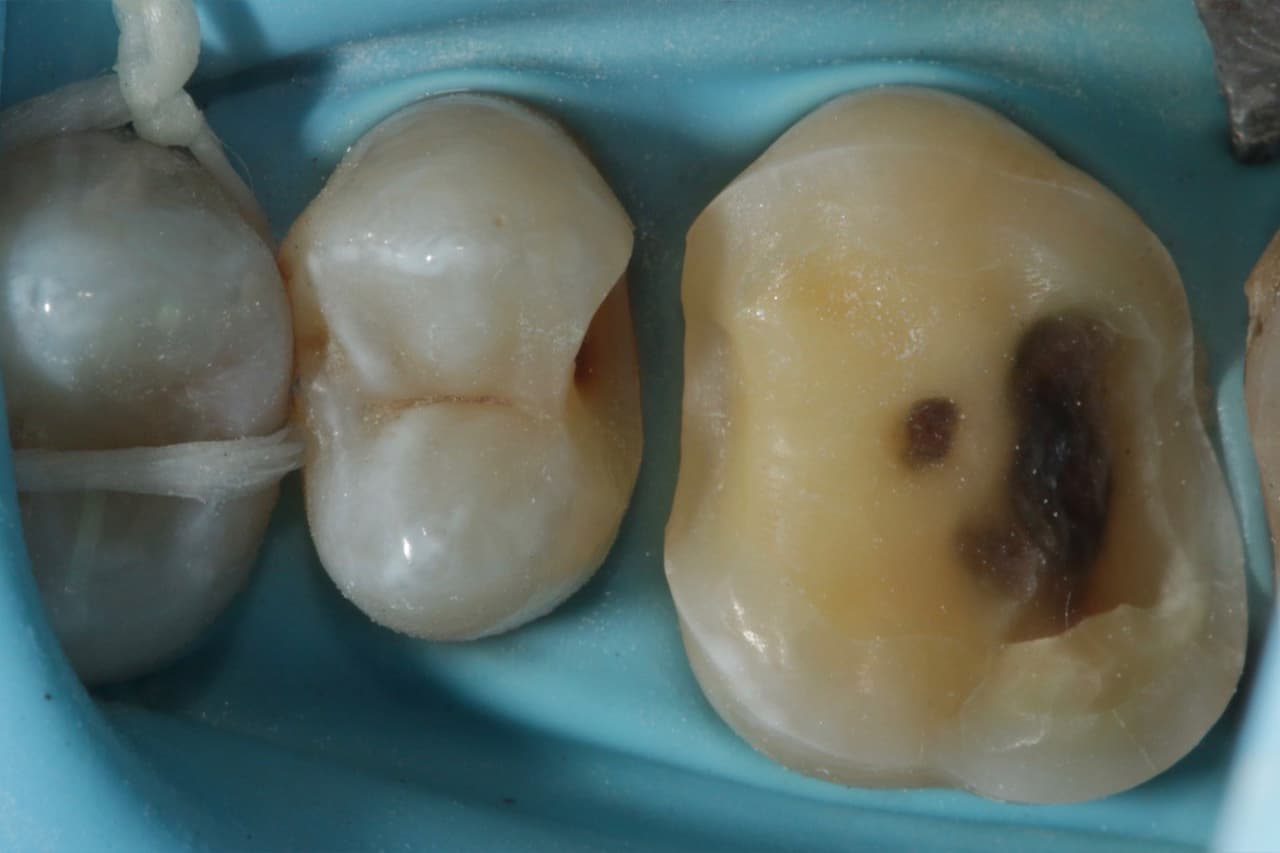 FIPO protocol step 4