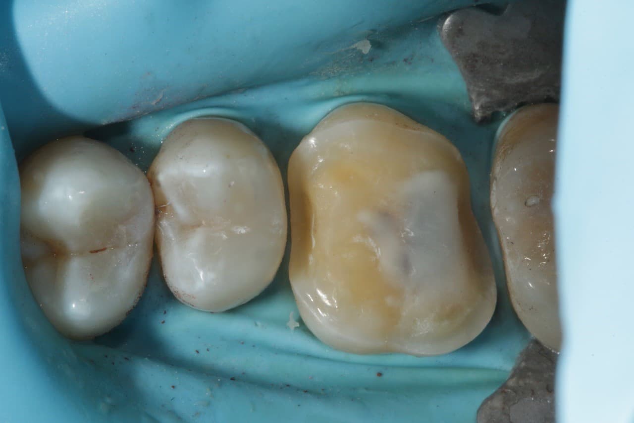 FIPO protocol step 5