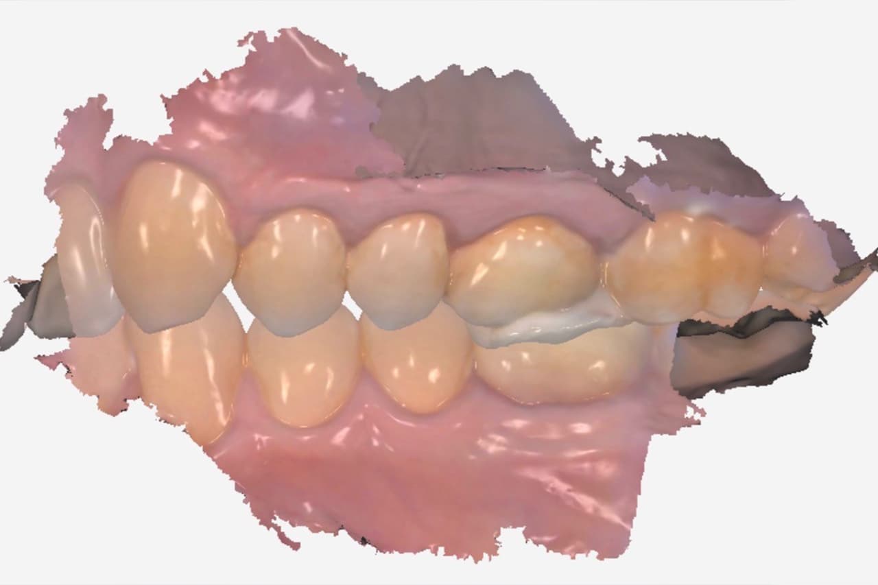 FIPO protocol step 6