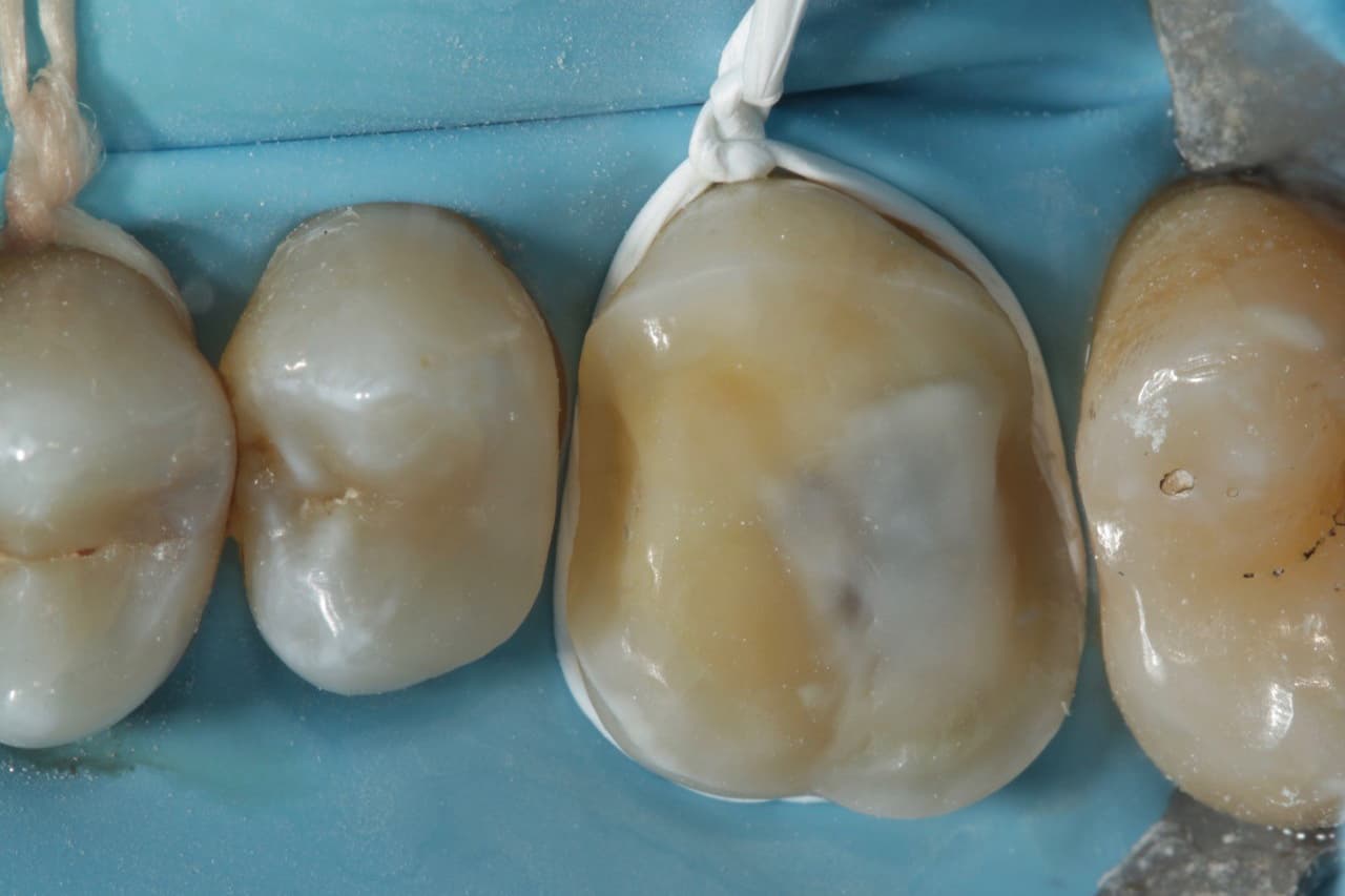 FIPO protocol step 7